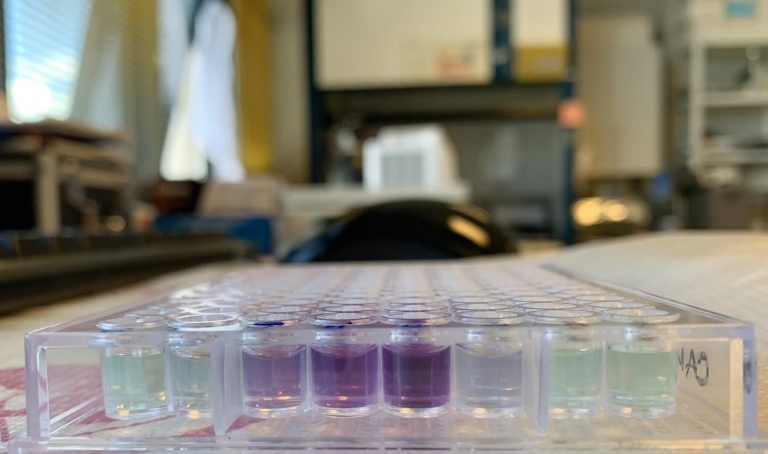 La Xunta pondrá en marcha en 2023 el Centro de fabricación de terapias avanzadas de Galicia para elaborar fármacos innovadores contra el cáncer