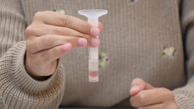 Más de 120 farmacias de Vigo participan en el programa de detección de casos de Covid