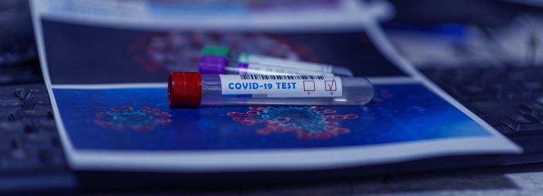 Sanidade investiga la venta ilegal de pruebas de diagnóstico de Covid