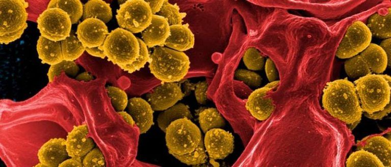 As superbacterias centran este luns unha charla do ciclo “Aida Fernández Ríos” no CPR Aloya de Vigo